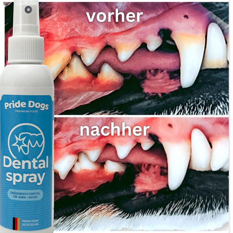 Dentalspray zur Zahnsteinentfernung